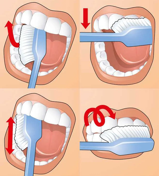Регулярные посещения стоматолога и чистка зубов профессиональными средствами