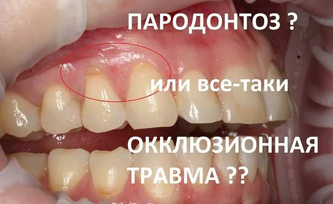 Регулярное чистка зубов и десен