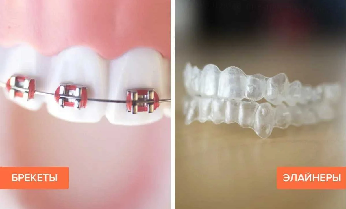 Связь между стоматологическим лечением и общим здоровьем пациента