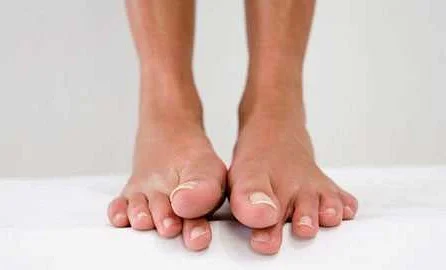 Правила профилактики боли во втором пальце на ноге