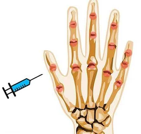 Причины боли в среднем пальце руки