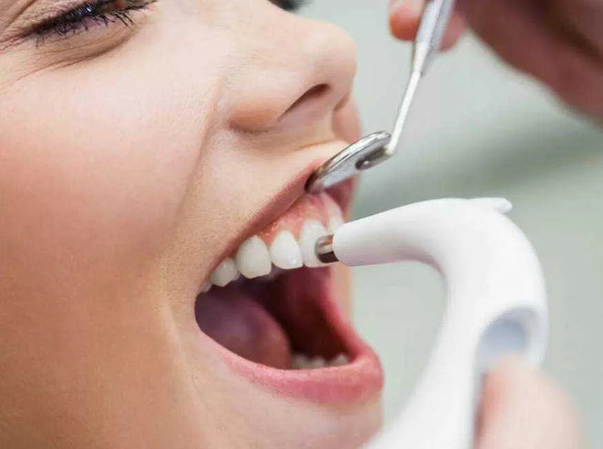 Почему важно бороться с зубным налетом?