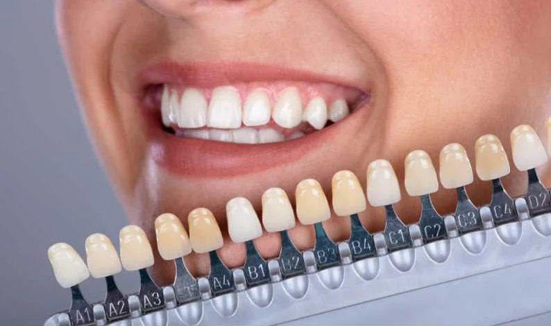 Борьба с зубным налетом: простые и эффективные средства