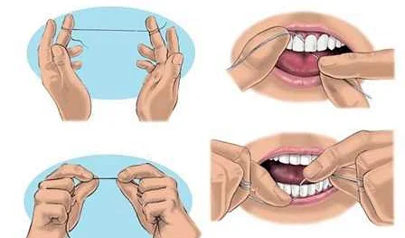 Регулярное использование зубной нити эффективно для ухода за полостью рта