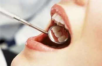 Исследование зубов и десен