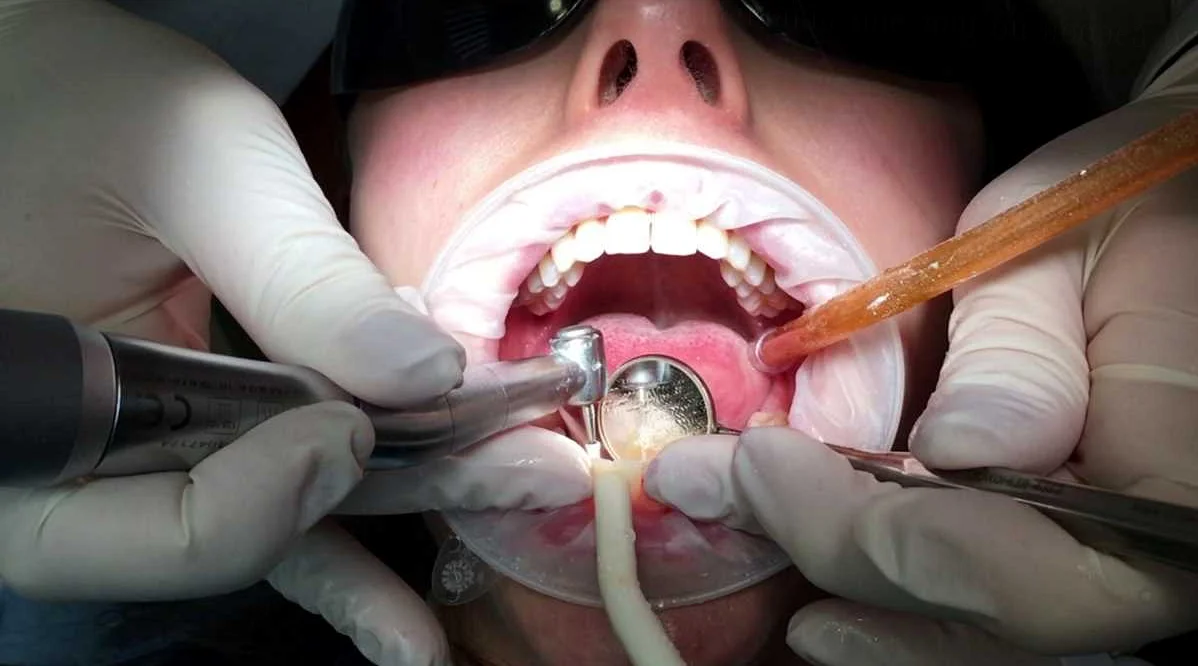 Что такое стоматологический осмотр и почему он важен
