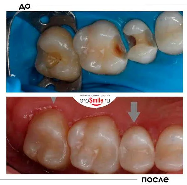 Роль детской стоматологии в общем здоровье