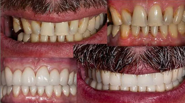 Влияние социальных сетей на эстетическую стоматологию