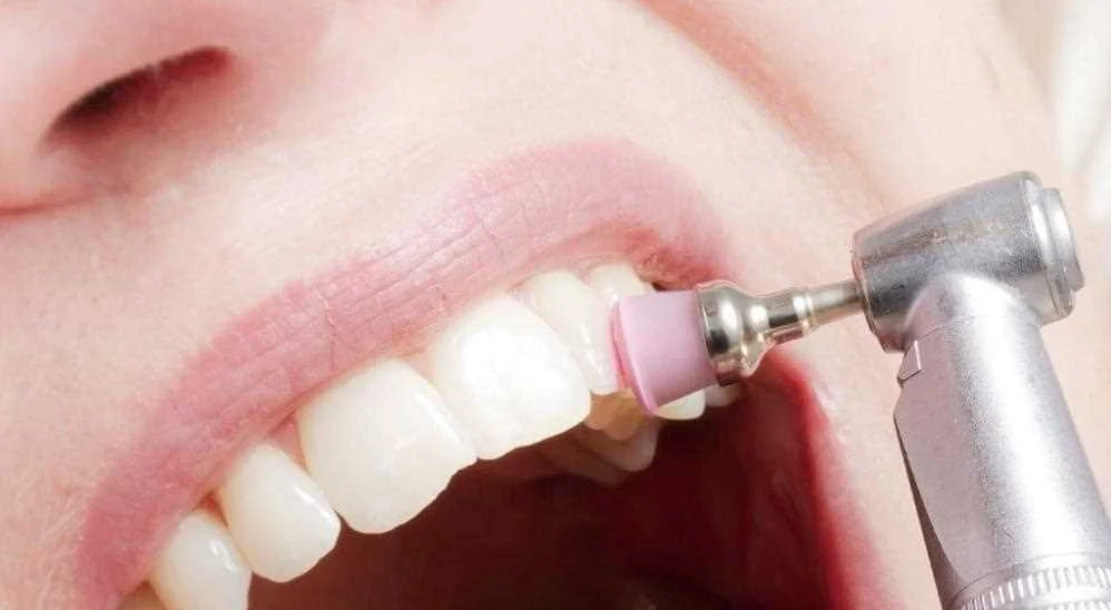 Гигиена зубов для предотвращения травм полости рта