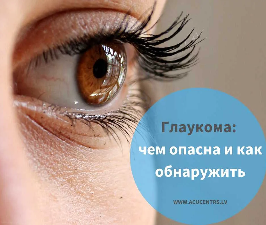 Как диагностируют глаукому глаза?