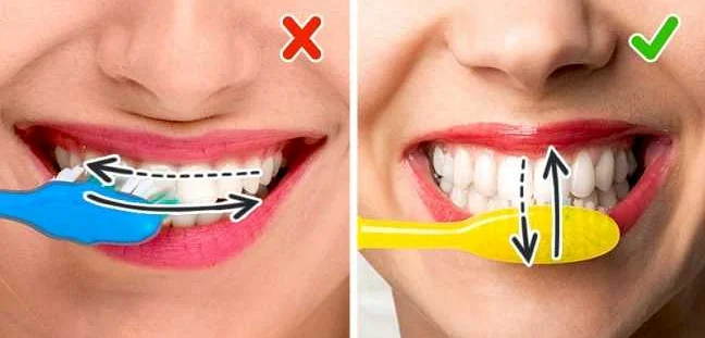 Идеальный гигиенический уход за зубами: чистка после еды