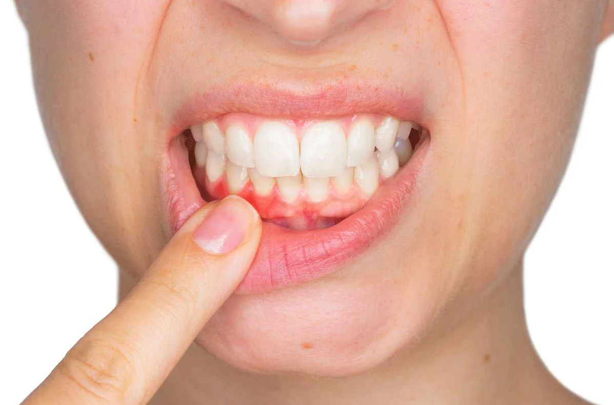 Взаимосвязь между гастроэнтерологическими заболеваниями и проблемами с зубами и деснами