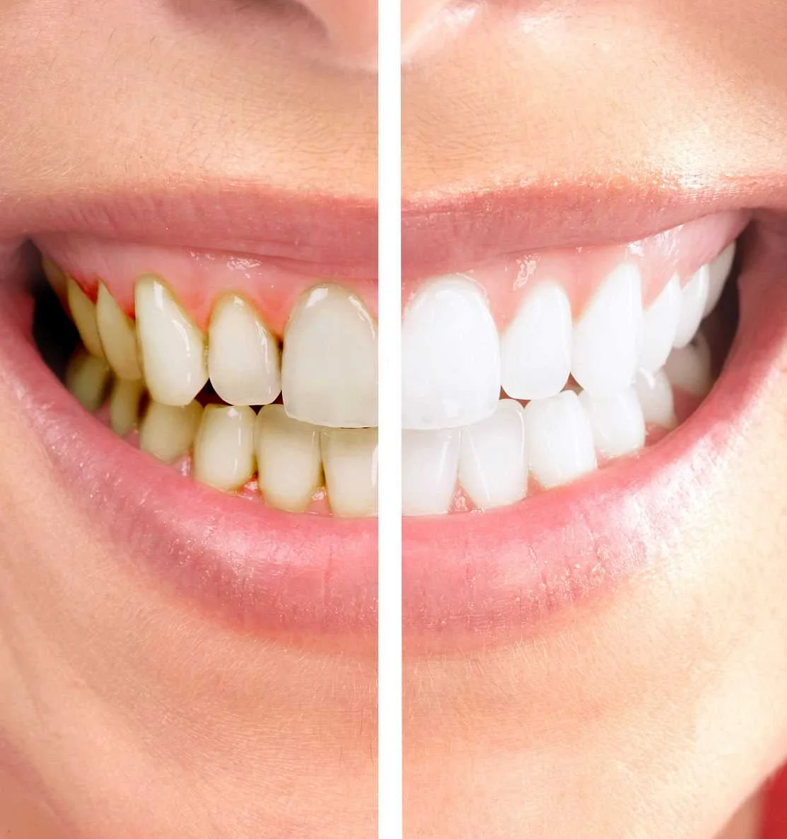 Какие гинекологические проблемы могут привести к ослаблению зубов и десен