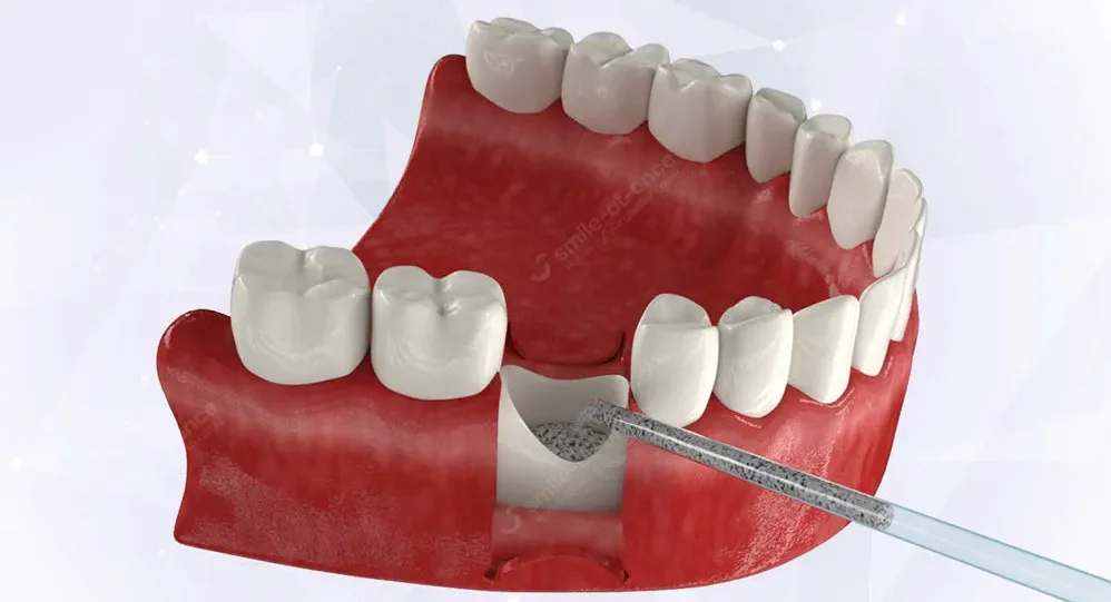 Как минимизировать влияние гормональных препаратов на здоровье зубов и десен