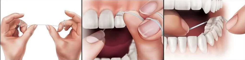 Польза использования зубной нити для профилактики зубного налета
