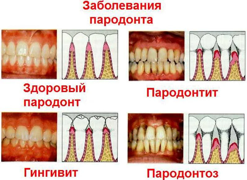 Зачем детям нужна стоматологическая гигиена?