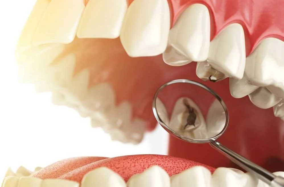 Состояние зубов и проблемы кожи: связь и влияние