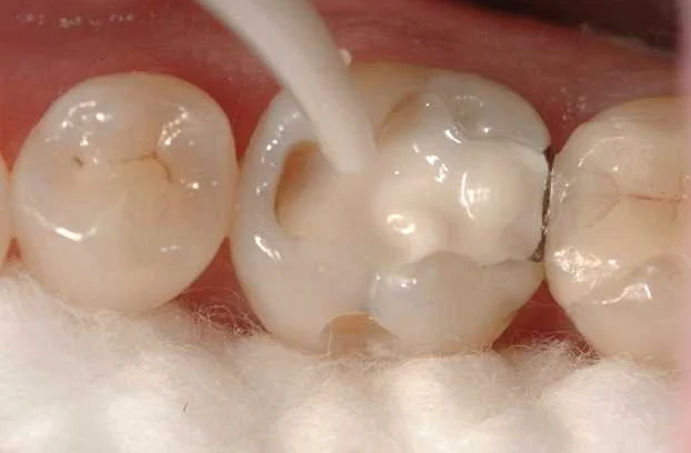 Патологии эндокринной системы и проблемы со здоровьем зубов