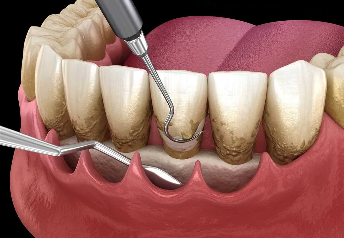 Как изменить лечение гастроэнтерологических заболеваний, чтобы минимизировать вред для зубов и десен