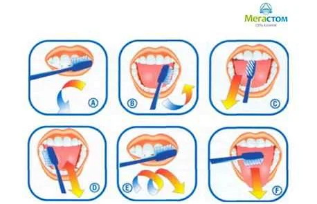 Применение зубной нити и интердентальных щеток