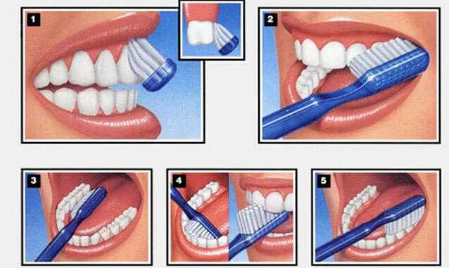 Правильное использование зубной нити для поддержания гигиены полости рта