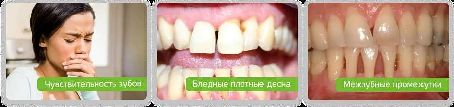 Важность регулярных посещений стоматолога для профилактики пародонтоза