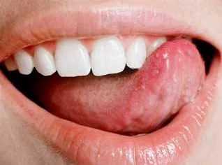 Важность регулярного чистки зубов и применения стоматологических средств