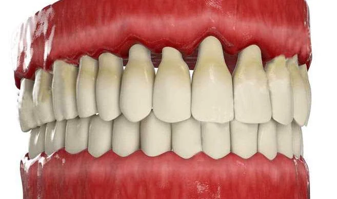 Стоматология: влияние зубных проблем на общее здоровье