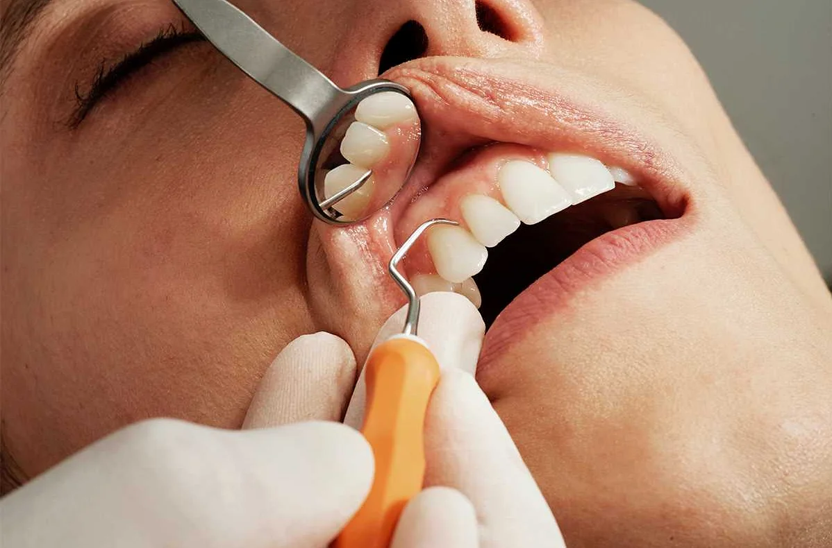 Дерматология и стоматология: связь между кожей и зубами