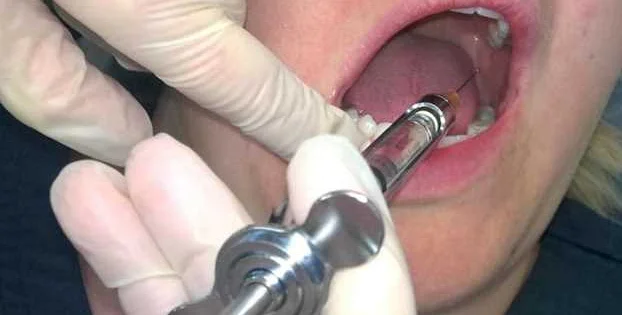 Как профилактические меры в стоматологии помогают предотвратить проблемы с урологическим здоровьем