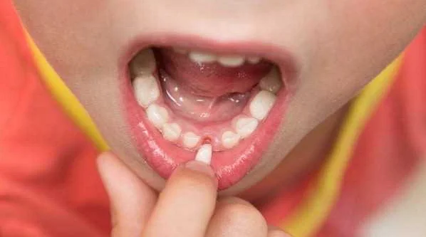 Полезные советы по уходу за зубами после травмы