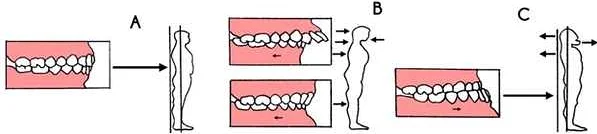 Основные преимущества правильного расположения зубов и челюстей