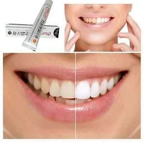 Эффективное отбеливание зубов с использованием светодиодной технологии