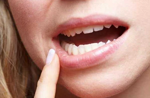 Влияние питания и образа жизни на здоровье зубов и кожи