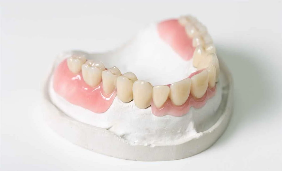 Как выбрать материал для зубных протезов