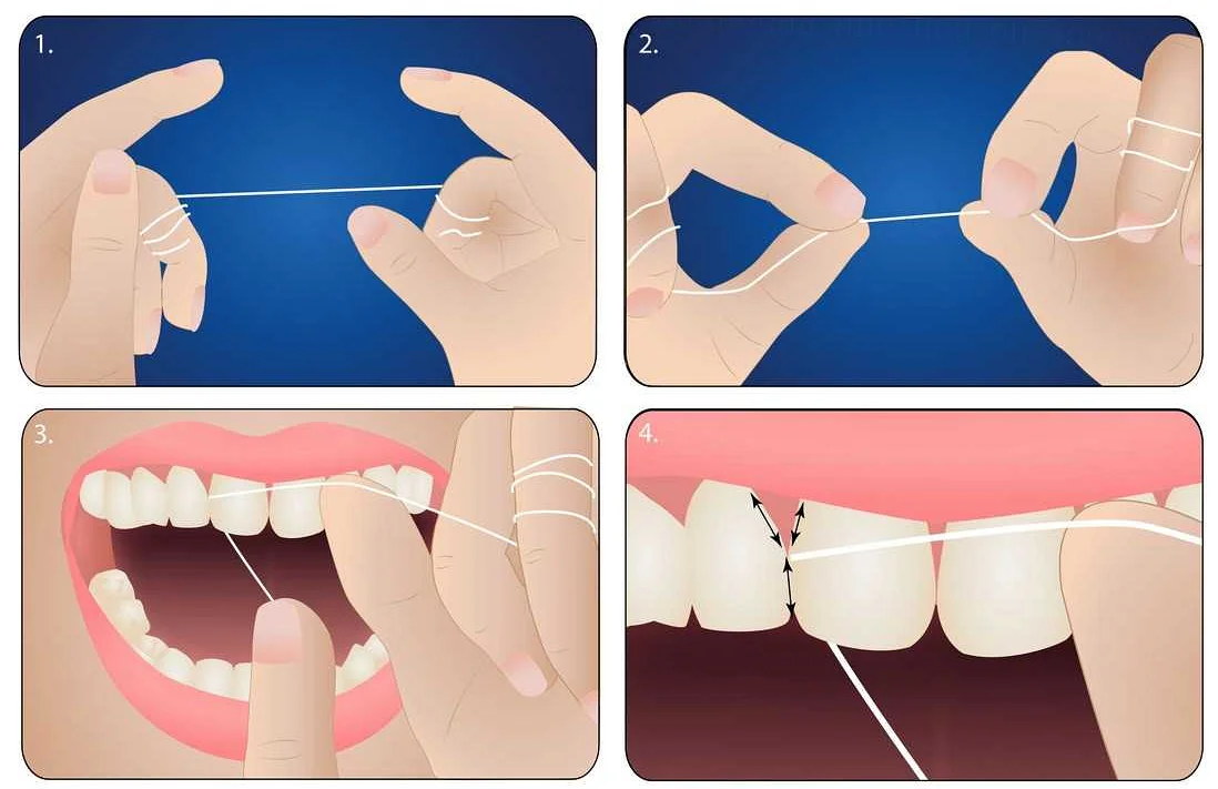 Рекомендации стоматолога по использованию детской зубной нити
