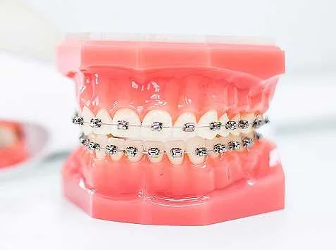 Предотвращает повреждения зубов и десен