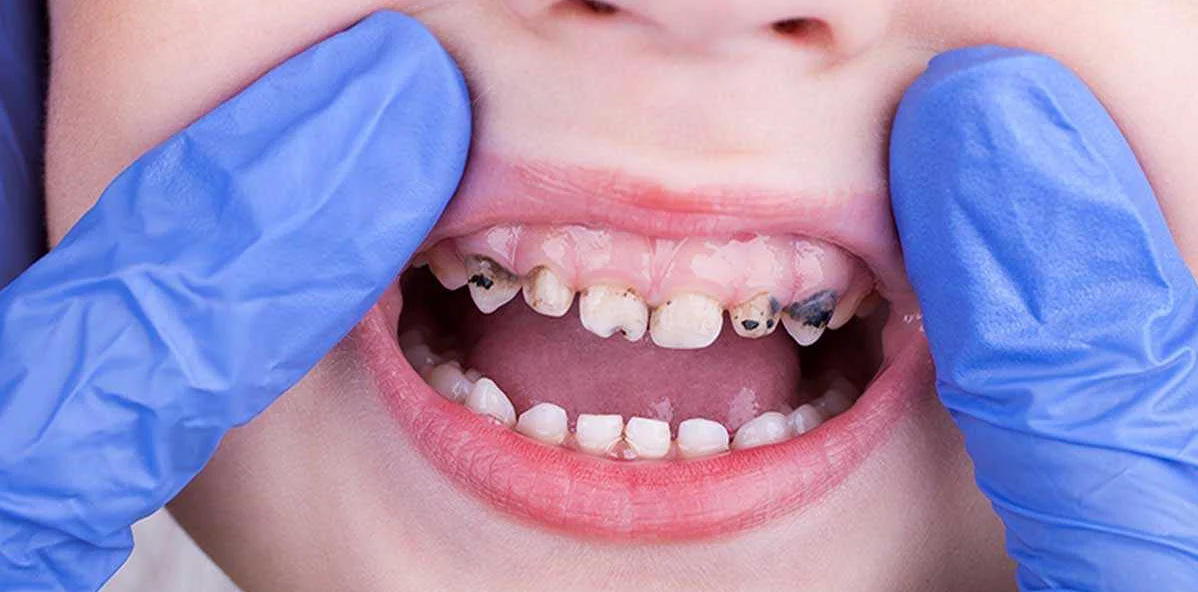 Какие проблемы с зубами и деснами могут быть обнаружены на стоматологическом осмотре?