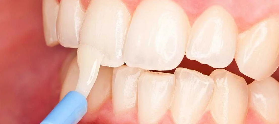 Питание для восстановления эмали зубов