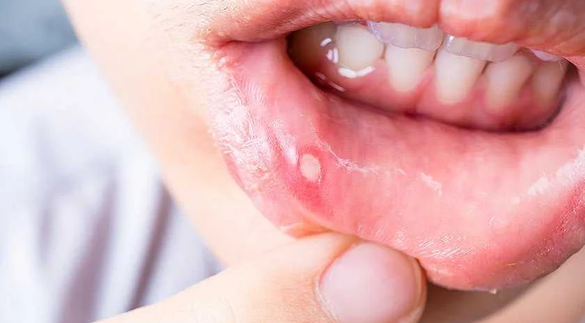Важность стоматологического осмотра для диагностики патологий полости рта