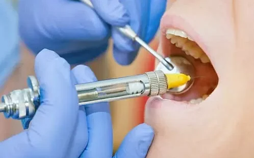 Как стоматологические процедуры помогают при лечении сердечной недостаточности?