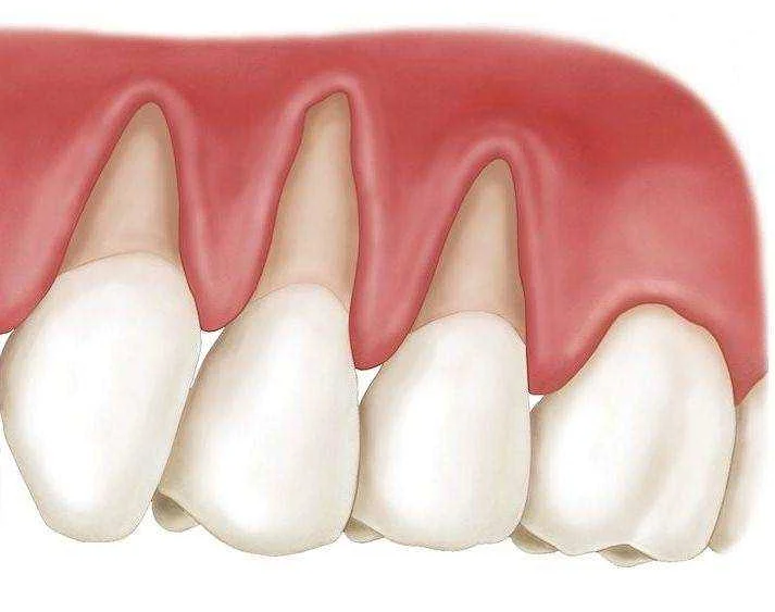 Основные показатели при проверке состояния зубов и десен