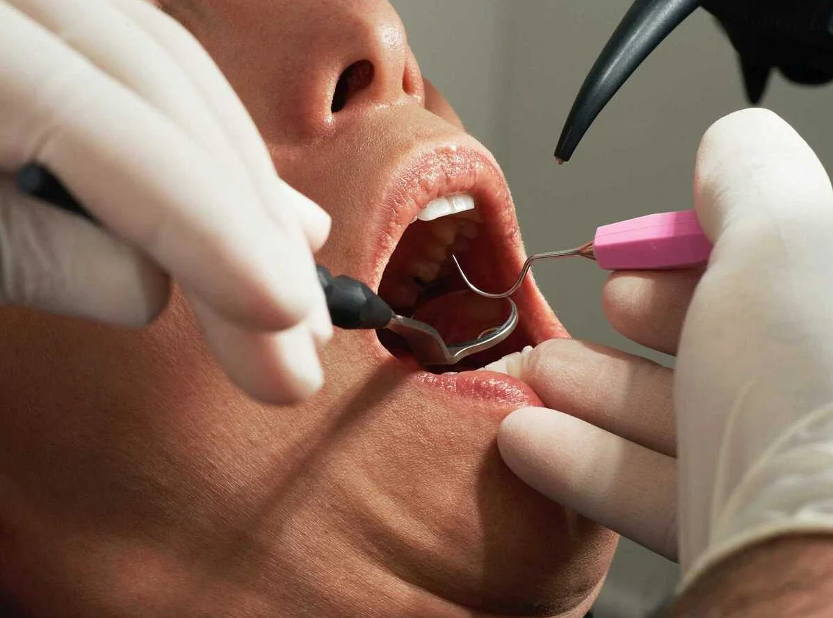 Какие заболевания стоматолог может выявить на ранней стадии