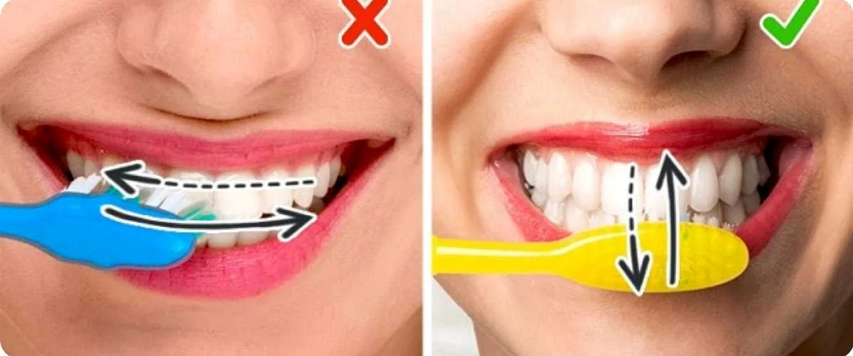 Инструменты для чистки зубов после еды