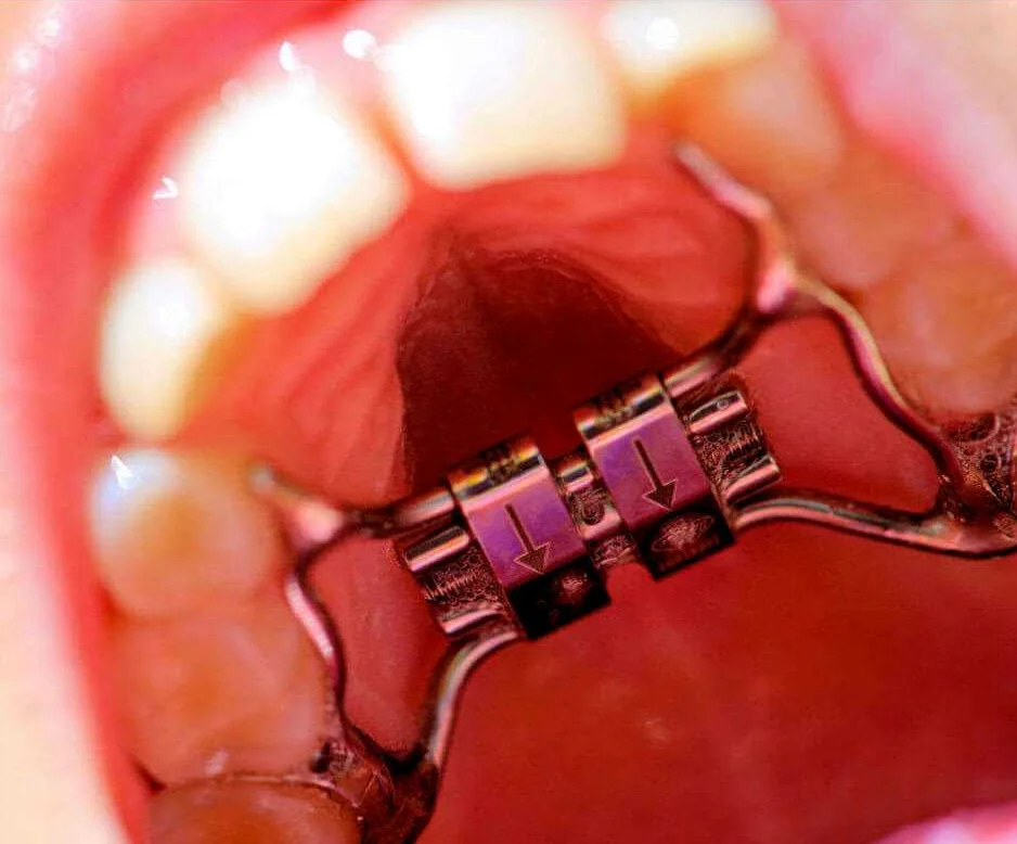 Основные принципы ортодонтии и выбор ортодонтического аппарата