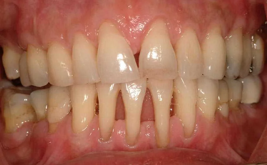 Регулярные посещения стоматолога: основа здоровья полости рта