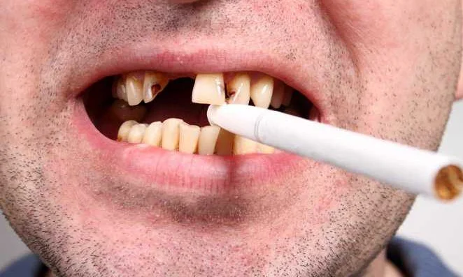 Курение и зубы: советы для поддержания здоровья полостной полости