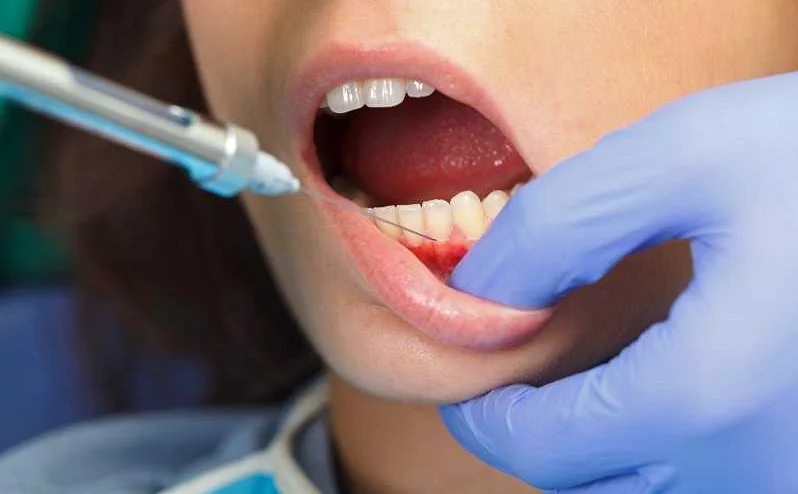 Лечение зубов без боли и дискомфорта: современные анестезиологические методы