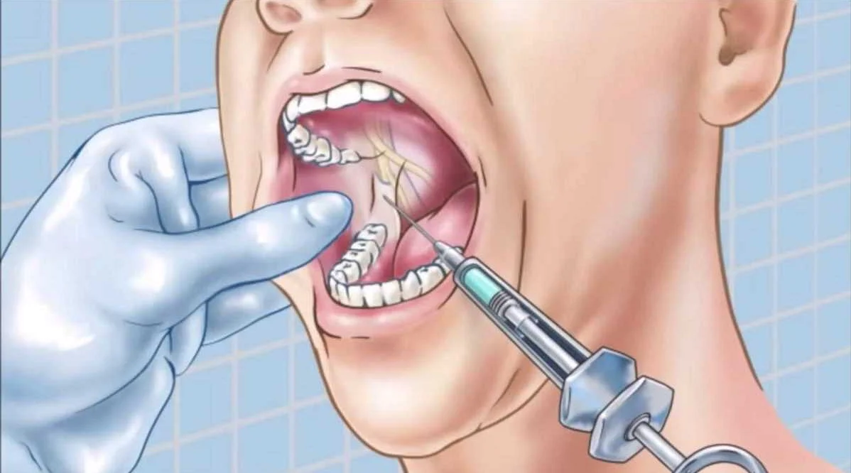 Новые подходы к анестезии в стоматологии