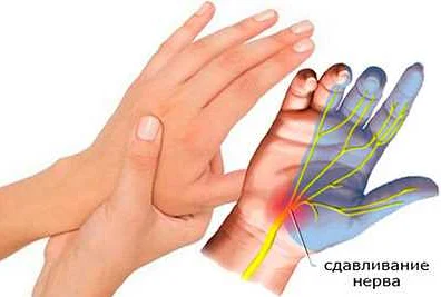 Травматологические методы лечения онемения пальца руки